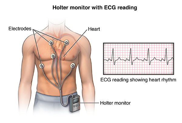 ECG Holter Monitoring (Extended 72 Hours - 1 Week) & Blood Pressure Holter