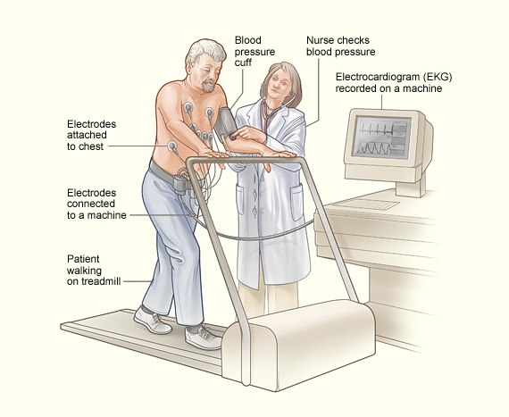 Exercise Stress Echocardiography